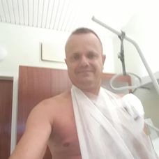 Milana čaká ešte jeden zákrok