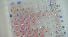 Pandémia zdvihla záujem o chrípkové očkovanie. Problém s nedostatkom vakcín sa môže opakovať