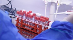 Vedci popísali ďalší následok „dlhého covidu“. Závery výskumu priblížili v štúdii