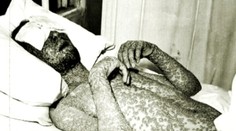 Kiahne ako biologická zbraň? Vedci majú jasno