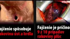 Varovný text na cigaretách nahradia tieto nechutné obrázky