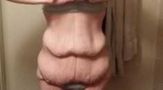 Schudla 100 kíl, no pohľad do zrkadla ju bolel. Dnes je z nej kosť