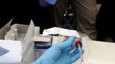 Česko hlási prvý prípad nakazenia nebezpečnou chorobou, ohniskom má byť Morava