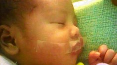 Bábätko v pôrodnici bolo príliš hlučné. Sestrička mu prelepila ústa páskou