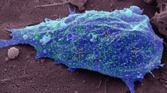 Vedci sú znepokojení novým subvariantom omikronu. Vyskytol sa už aj v Európe