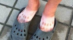 Tak takto by ste sa určite nechceli opáliť