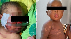 Hrôza, ktorá sa skončila zázrakom. Matka zakopala novonarodené dievčatko, napokon ho zachránili príbuzní