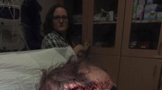 Muž sa natočil na video bezprostredne po tom, ako ho medveď takmer oskalpoval