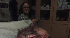 Muž sa natočil na video bezprostredne po tom, ako ho medveď takmer oskalpoval