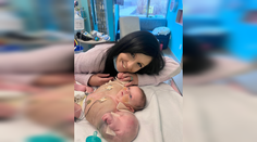 Nedávali jej žiadnu šancu na prežitie. Dievčatko trpiace vzácnou vrodenou poruchou prirovnávajú k superhrdinovi