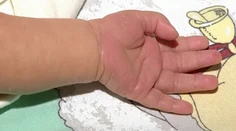 Nemocnica v Trnave zmrzačila malého Adamka. Zaplatí pol milióna eur