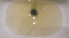 Obce v okolí Levíc trápi hrdzavá voda. Vodári tvrdia, že ide iba o estetický problém