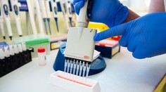 V laboratóriách potvrdili 155 nových prípadov variantu omikron na Slovensku