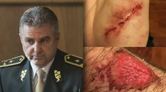 Pri zásahu policajtov sa zranil chlapec: Podľa Gašpara nedošlo k pochybeniu