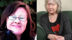 Žena omdlela a pes jej „zjedol" tvár. Verí však, že jej zachránil život