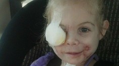 Dohryzené dieťa (3) vyhodili z fast foodu. Vraj desilo zákazníkov