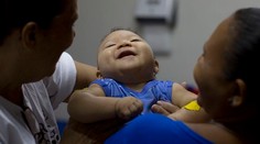 Na východe USA sa narodilo prvé dieťa postihnuté vírusom zika