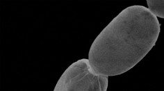 VIDEO: V poraste našli najväčšiu baktériu na svete. Je viditeľná voľným okom