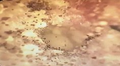 VIDEO: Pacient sa sťažoval na nedoslýchavosť. Keď lekár prezrel ucho, zostal v šoku