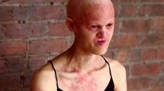 Nemajú vlasy, zuby, niekedy ani končatiny. Aj tak sa živia ako modelky