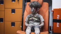 Fotka zraneného chlapca v Sýrii obletela celý svet. Takto vyzerá dnes