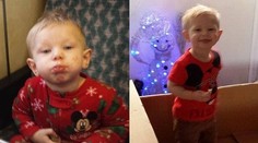 To by ste nechceli! Chlapček je alergický na Vianoce