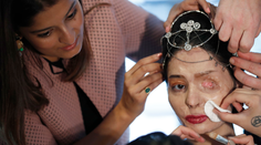 Modelku znetvorili kyselinou. Napriek hendikepu zahviezdila na móle