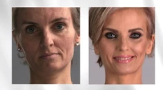 Nové zuby aj prsia! Z čašníčky Jany je po premene hotová modelka
