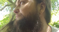 Táto žena má síce bradu a fúzy, no cíti sa sexy a žensky