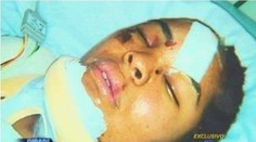 Šialenec sotil mladú ženu (27) pod metro. Odtrhlo jej to ruku