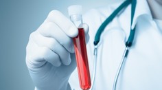 Vedci vyvinuli nový krvný test. Ten odhalí, či do 10 rokov zomriete