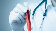 Vedci vyvinuli krvný test s veľkou presnosťou. Už v zárodku odhalí 50 druhov rakoviny
