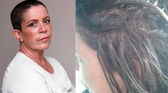 Kaderníčka nadpojila žene vlasy sekundovým lepidlom. Skončila holohlavá!