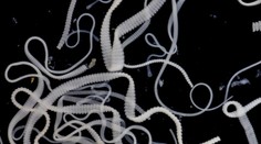 Muž sa sťažoval na veľké bolesti. V mozgu mu našli 700 lariev pásomnice