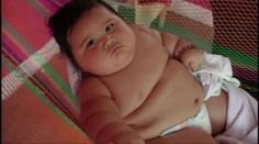 Najtučnejšie dieťa Kolumbie. Má osem mesiacov a 25 kíl