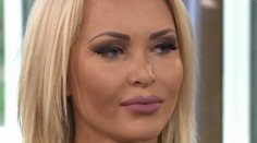 Má len 22 rokov a množstvo plastík. Prezradila, koľko ju to stálo
