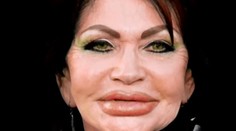 Keď staré chcú mladé byť. Kedy už prekročia hranice?