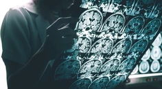 Nový liek spomaľuje postup Alzheimerovej choroby o tretinu. Má však nebezpečné vedľajšie účinky