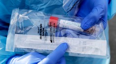 Francúzski vedci zistili, že kombinácia týchto dvoch liekov účinkuje na koronavírus