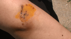 Ženu napadol pes, nahuckal ho jeho majiteľ