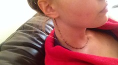 Postúpila do finále miss, teraz sa však cíti ako Frankenštajn