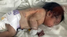 Keby ho nenašli, do hodiny by zomrelo. Dievčatko, ktoré sa narodilo pod troskami, dostalo krásne meno