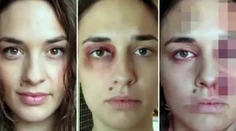 Volanie o pomoc! Video s fotkami ženy, ktorú mláti priateľ