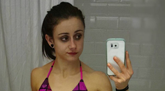 Bývalá anorektička zverejnila najhoršiu fotku života. Vážila len 30 kíl