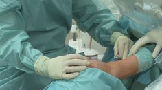 Rýchlejšie hojenie rán, menej jaziev aj bolesti. V Košiciach operujú nohy unikátnou metódou