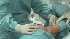 Rýchlejšie hojenie rán, menej jaziev aj bolesti. V Košiciach operujú nohy unikátnou metódou