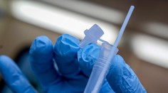 Opäť máme viac ako 20-tisíc pozitívnych, covidu podľahlo 24 pacientov