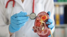 Horšia bolesť ako pri pôrode. Urológ vysvetlil, prečo by sme mali dbať na starostlivosť o obličky