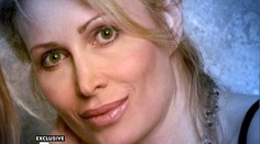 Z krásky sa stal netvor! Žena po nepodarenej plastike takmer spáchala samovraždu