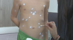 V Bratislave evidujú zvýšený výskyt ovčích kiahní. Nepoužívajte na ne zásypy ani púdre